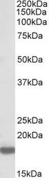 Anti-Pleiotrophin antibody, Internal used in Western Blot (WB). GTX88200