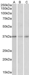Anti-GHITM antibody, Internal used in Western Blot (WB). GTX88206