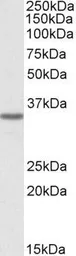 Anti-GHITM antibody, Internal used in Western Blot (WB). GTX88206