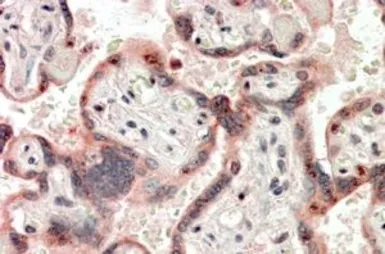 Anti-Cripto antibody, Internal used in IHC (Paraffin sections) (IHC-P). GTX88209