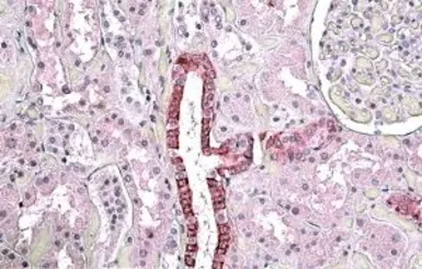 Anti-TGFBI antibody, Internal used in IHC (Paraffin sections) (IHC-P). GTX88213