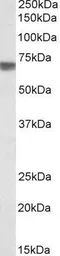 Anti-TGFBI antibody, Internal used in Western Blot (WB). GTX88213