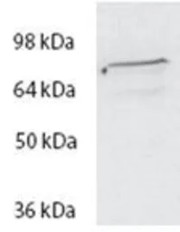 Anti-SPARTIN antibody, Internal used in Western Blot (WB). GTX88225