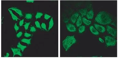 Anti-SPARTIN antibody, Internal used in Immunocytochemistry/ Immunofluorescence (ICC/IF). GTX88225