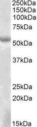 Anti-EYA1 antibody, Internal used in Western Blot (WB). GTX88229