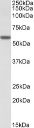 Anti-DIXDC1 antibody, Internal used in Western Blot (WB). GTX88233