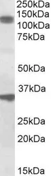 Anti-CCAR1 antibody, Internal (near C-Terminus) used in Western Blot (WB). GTX88234