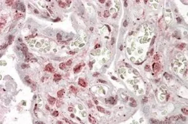 Anti-MLX antibody, Internal used in IHC (Paraffin sections) (IHC-P). GTX88235