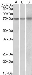 Anti-KLHL6 antibody, Internal used in Western Blot (WB). GTX88252