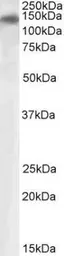 Anti-PLA2R1 antibody, Internal used in Western Blot (WB). GTX88257