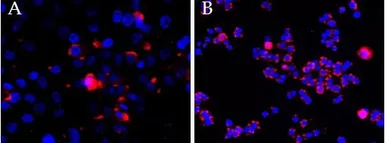 Anti-CEP290 antibody, Internal used in Immunocytochemistry/ Immunofluorescence (ICC/IF). GTX88258