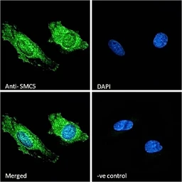 Anti-SMC5 antibody, Internal used in Immunocytochemistry/ Immunofluorescence (ICC/IF). GTX88264