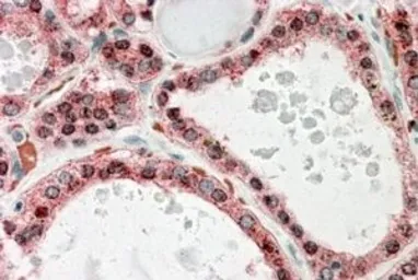 Anti-KCNN2 antibody, Internal used in IHC (Paraffin sections) (IHC-P). GTX88269