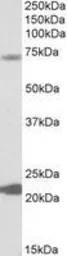 Anti-KCNN2 antibody, Internal used in Western Blot (WB). GTX88269