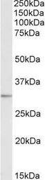 Anti-EB3 antibody, Internal used in Western Blot (WB). GTX88277