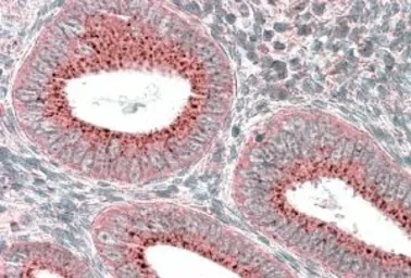 Anti-SNX1 antibody, Internal used in IHC (Paraffin sections) (IHC-P). GTX88278