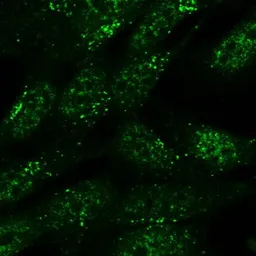 Anti-SNX1 antibody, Internal used in Immunocytochemistry/ Immunofluorescence (ICC/IF). GTX88278