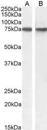 Anti-SNX1 antibody, Internal used in Western Blot (WB). GTX88278