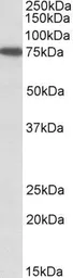Anti-SNX1 antibody, Internal used in Western Blot (WB). GTX88278