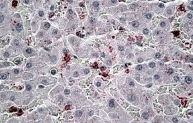 Anti-MIP3 alpha antibody, Internal used in IHC (Paraffin sections) (IHC-P). GTX88282