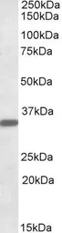 Anti-FGL1 antibody, Internal used in Western Blot (WB). GTX88289