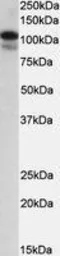 Anti-SATB1 antibody, Internal used in Western Blot (WB). GTX88290