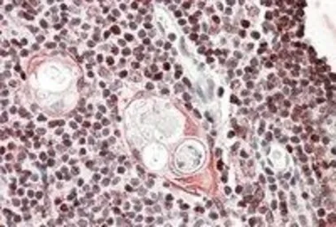 Anti-SATB1 antibody, Internal used in IHC (Paraffin sections) (IHC-P). GTX88290