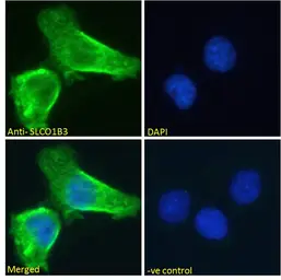 Anti-OATP8 antibody, Internal used in Immunocytochemistry/ Immunofluorescence (ICC/IF). GTX88295