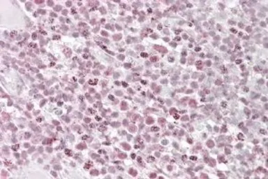 Anti-Ikaros antibody, Internal used in IHC (Paraffin sections) (IHC-P). GTX88298