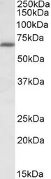 Anti-Ikaros antibody, Internal used in Western Blot (WB). GTX88298