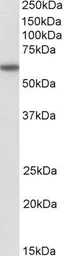 Anti-CD80 antibody, Internal used in Western Blot (WB). GTX88300