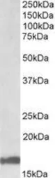 Anti-Galanin antibody, Internal used in Western Blot (WB). GTX88303