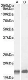 Anti-Galanin antibody, Internal used in Western Blot (WB). GTX88303