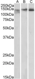 Anti-SA2 antibody, Internal used in Western Blot (WB). GTX88304