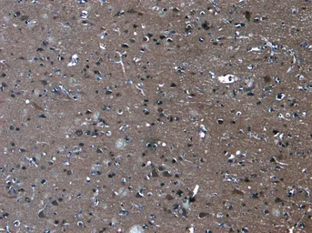 Anti-PCDH11 antibody, Internal used in IHC (Paraffin sections) (IHC-P). GTX88306