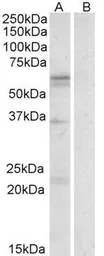 Anti-LAT1 / SLC7A5 antibody, Internal used in Western Blot (WB). GTX88312