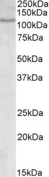 Anti-NFAT1 antibody, Internal used in Western Blot (WB). GTX88316