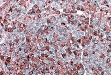 Anti-NFAT1 antibody, Internal used in IHC (Paraffin sections) (IHC-P). GTX88316