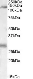 Anti-MAP3K6 antibody, C-term used in Western Blot (WB). GTX88318
