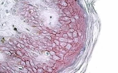 Anti-Desmoglein 1 antibody, Internal used in IHC (Paraffin sections) (IHC-P). GTX88319