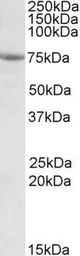 Anti-AARSD1 antibody, Internal used in Western Blot (WB). GTX88320