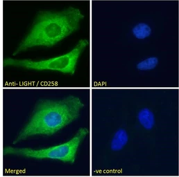Anti-LIGHT antibody, Internal used in Immunocytochemistry/ Immunofluorescence (ICC/IF). GTX88321