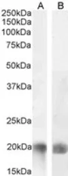Anti-LIGHT antibody, Internal used in Western Blot (WB). GTX88321