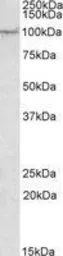 Anti-AAK1 antibody, Internal used in Western Blot (WB). GTX88323