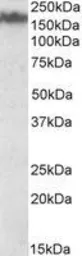 Anti-NF-M antibody, Internal used in Western Blot (WB). GTX88324
