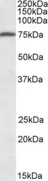 Anti-URP2 antibody, C-term used in Western Blot (WB). GTX88332