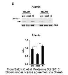 Anti-AFM antibody, Internal used in Western Blot (WB). GTX88333