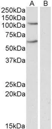 Anti-IREB2 antibody, Internal used in Western Blot (WB). GTX88335