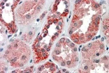 Anti-IREB2 antibody, Internal used in IHC (Paraffin sections) (IHC-P). GTX88335