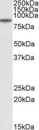 Anti-GGCX antibody, C-term used in Western Blot (WB). GTX88337